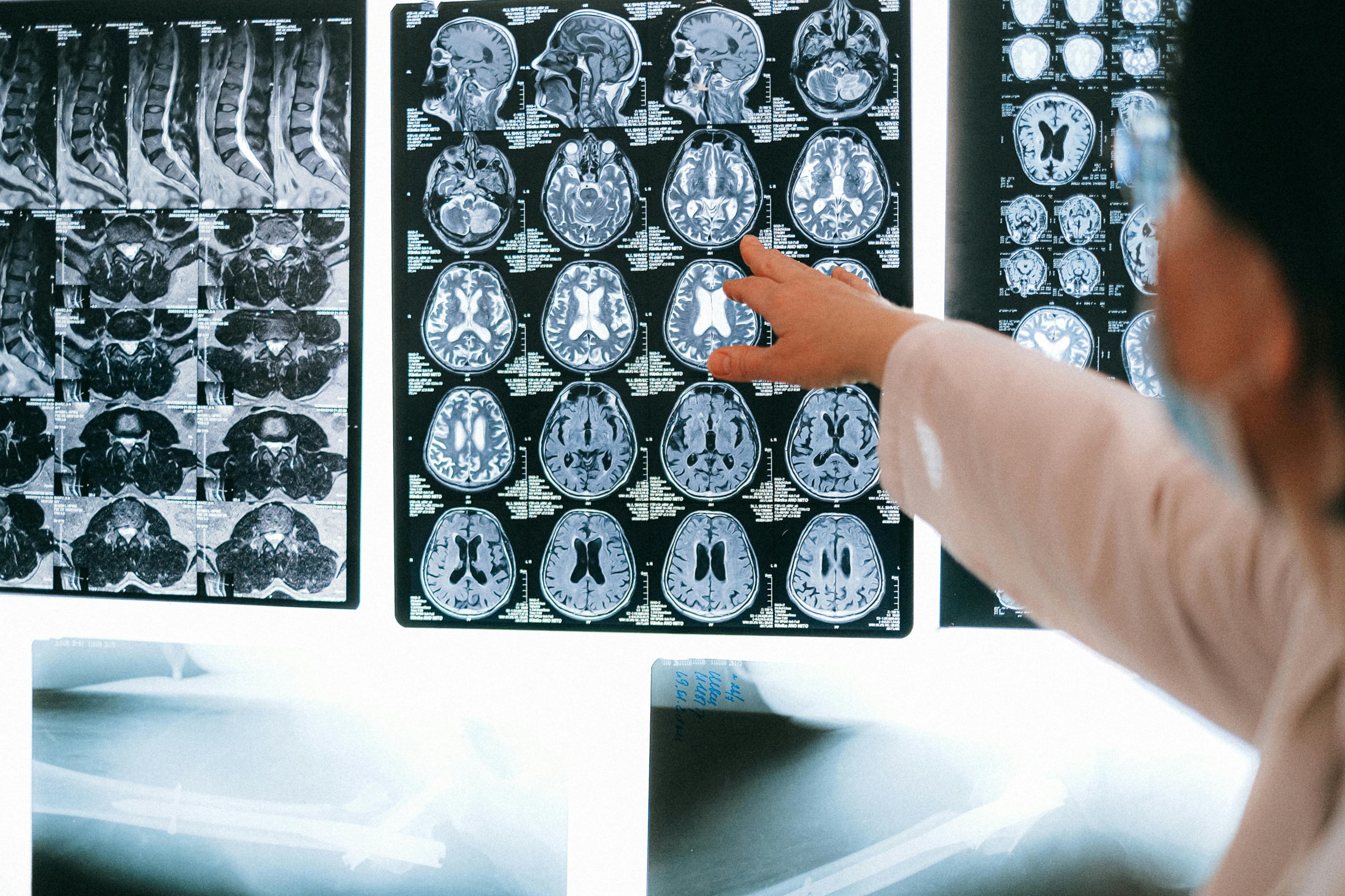 Türkiye'nin İlk Yerli MRI Cihazı Geliştirildi
